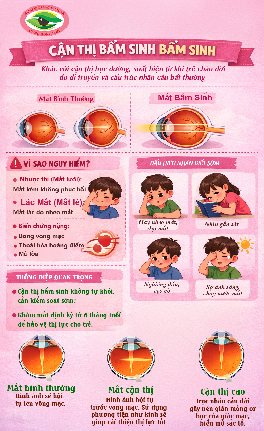 Cận thị bẩm sinh ở trẻ em: Những điều cha mẹ cần biết